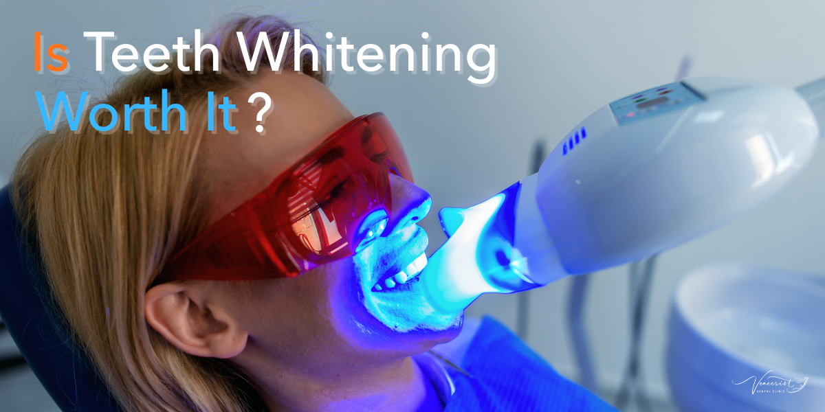 HOME - English 31 Is Teeth Whitening Worth It