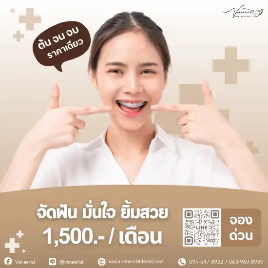 โปรจัดฟัน