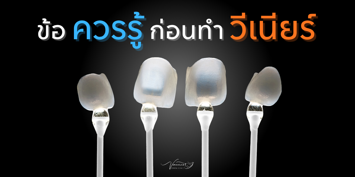ข้อควรรู้ก่อนทำวีเนียร์
