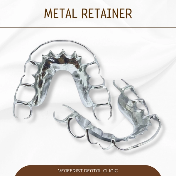 Metal retainer 4 11zon