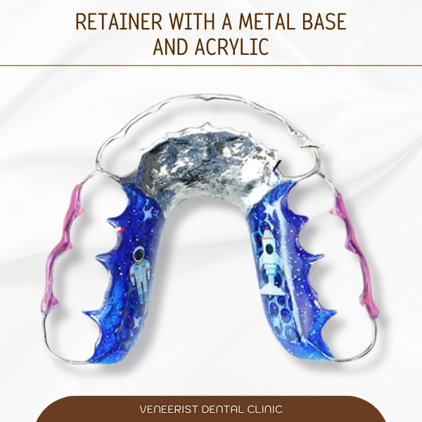 Retainer with a metal base and acrylic 5 11zon
