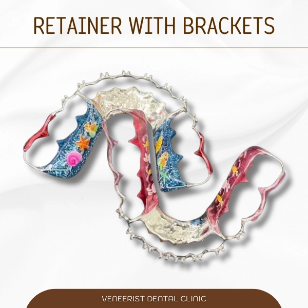 Retainer with brackets 6 11zon