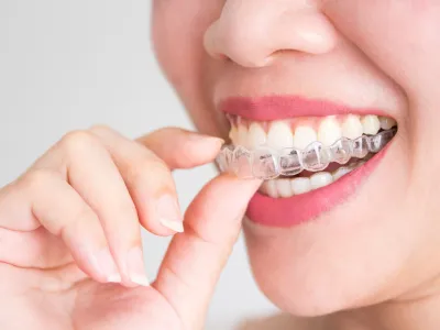 จัดฟันใส (Invisalign TrioClear)