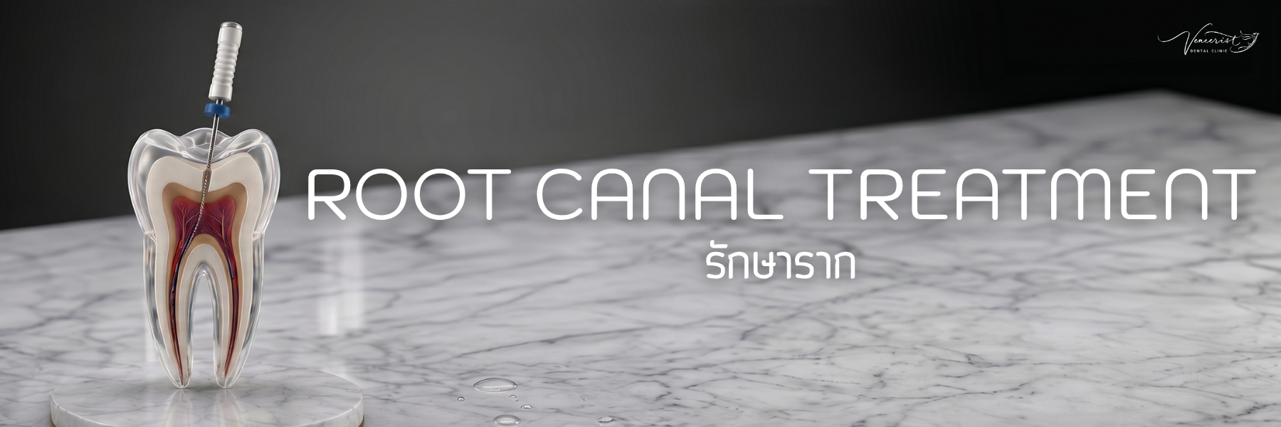 รักษารากฟัน