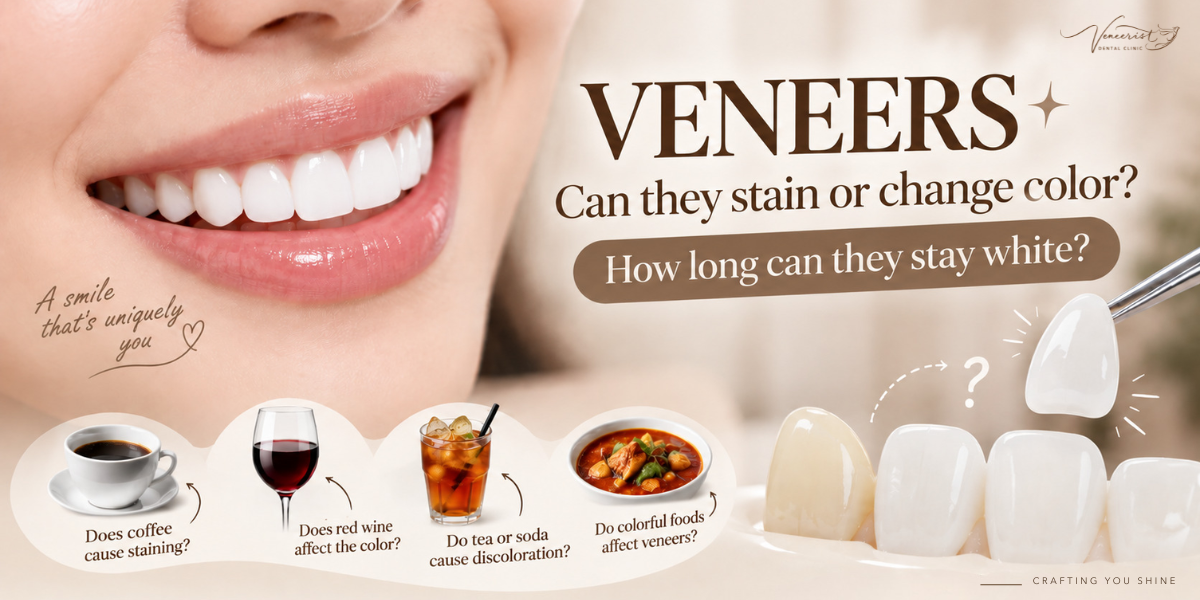 Do Ceramic Veneers stain or change color from coffee and dark-colored drinks