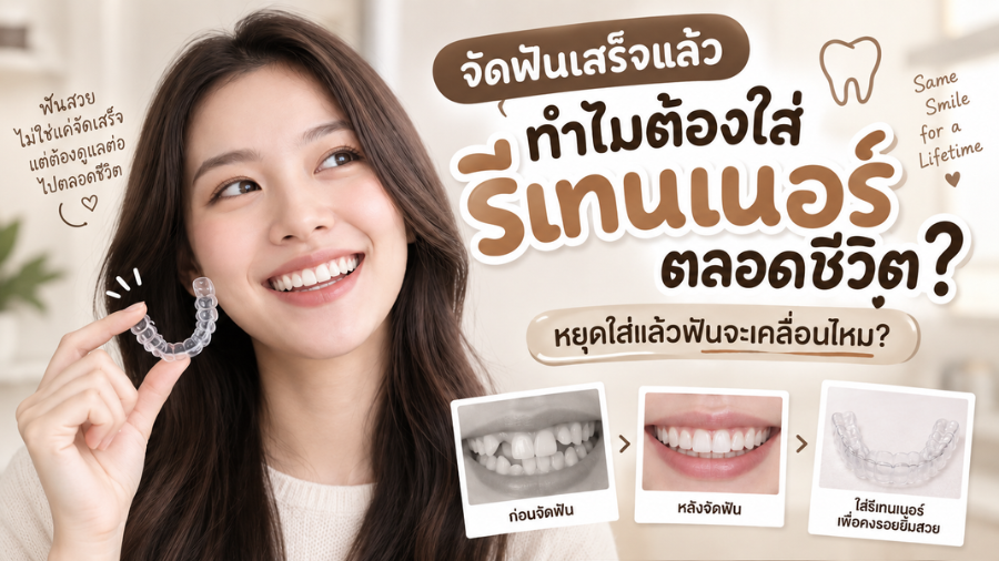 ทำไมต้องใส่รีเทนเนอร์ตลอดชีวิตหลังจัดฟัน รีเทนเนอร์ช่วยรักษาตำแหน่งของฟัน