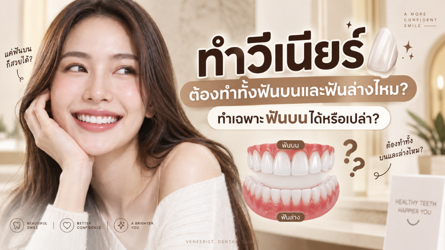 ทำวีเนียร์ต้องทำทั้งฟันบนและฟันล่างไหม การวางแผน Ceramic Veneers และ Smile Design