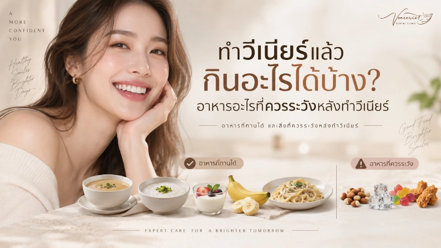 HOME 41 ทำวีเนียร์แล้วกินอะไรได้บ้าง อาหารและพฤติกรรมที่ควรระวังหลังทำ Ceramic Veneers