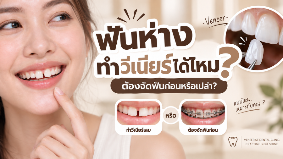 ฟันห่างทำวีเนียร์ได้ไหม Ceramic Veneers สำหรับปิดช่องว่างระหว่างฟันหน้า