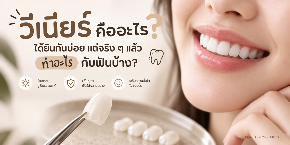 วีเนียร์คืออะไร Ceramic Veneer ช่วยปรับสี รูปร่าง และสัดส่วนของฟัน