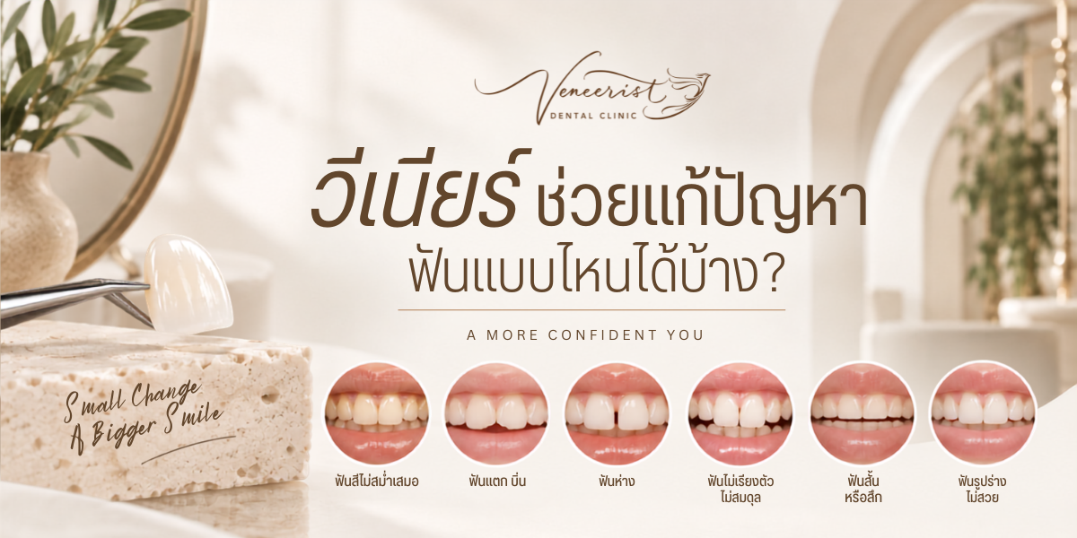 วีเนียร์ช่วยแก้ปัญหาฟันอะไรได้บ้าง สีฟัน ฟันบิ่น ช่องว่าง และรูปร่างฟัน