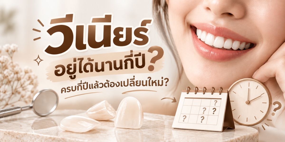 วีเนียร์อยู่ได้นานกี่ปี อายุการใช้งานของ Ceramic Veneers และ Composite Veneers