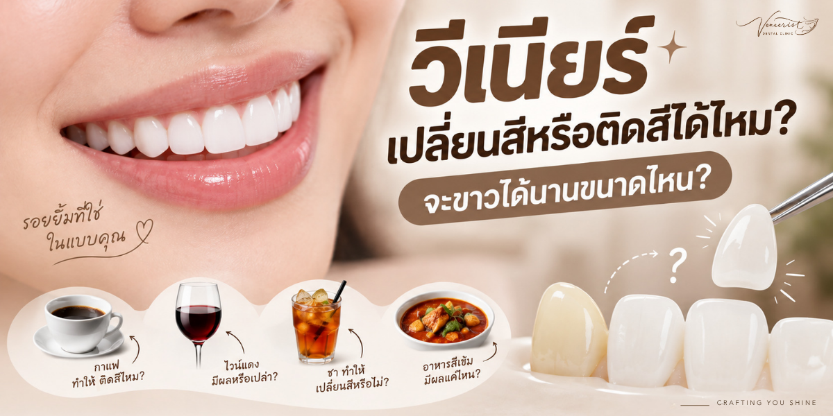 วีเนียร์เปลี่ยนสีหรือติดสีได้ไหม Ceramic Veneer และคราบจากกาแฟ