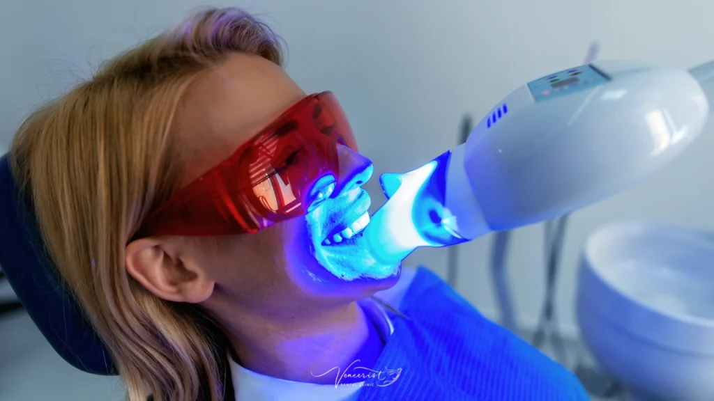 ฟอกสีฟันแล้วกลับมาเหลืองไหม? ทำอย่างไรให้ฟันขาวนาน | Veneerist 1 LED Cool Light Teeth Whitening Veneerist
