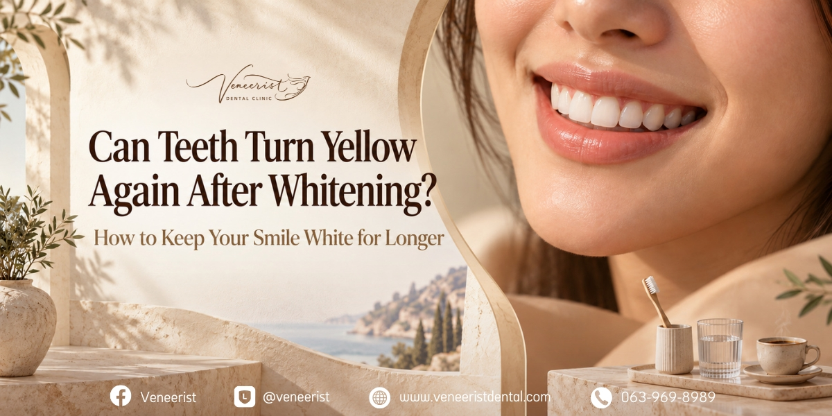 HOME - English 59 Do teeth turn yellow again after whitening? Tooth colour changes and ways to maintain whitening results