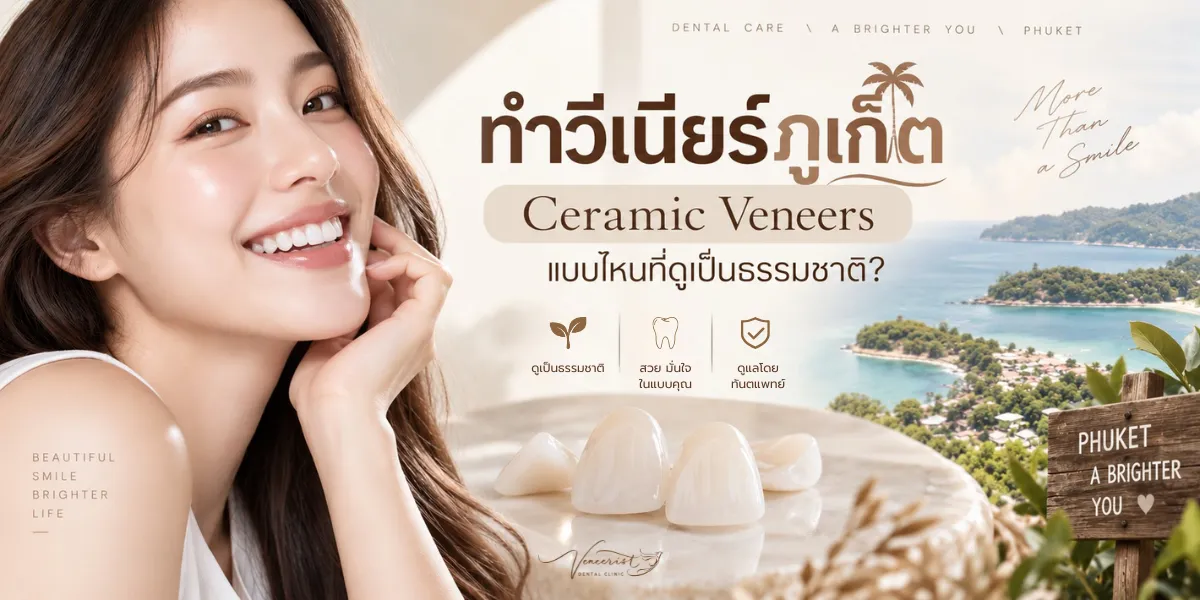 ทำวีเนียร์ภูเก็ต Ceramic Veneers ที่ดูเป็นธรรมชาติ และทางเลือกสำหรับผู้ที่สนใจเดินทางมาทำที่กระบี่