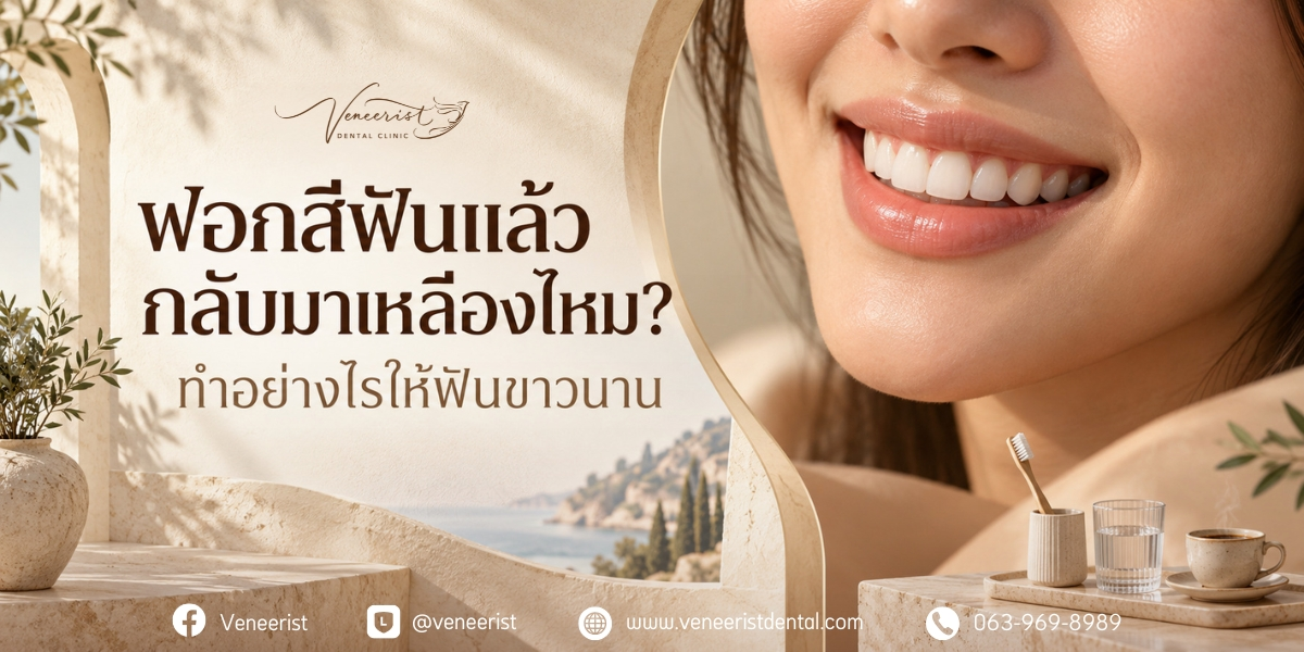 ฟอกสีฟันแล้วกลับมาเหลืองไหม การเปลี่ยนแปลงของสีฟันหลังฟอกสีฟัน