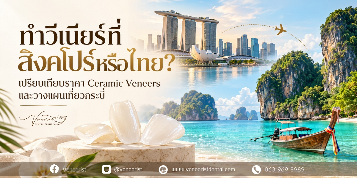 เปรียบเทียบการทำเซรามิกวีเนียร์ที่สิงคโปร์และประเทศไทย พร้อมการวางแผนเดินทางมาทำวีเนียร์ที่กระบี่