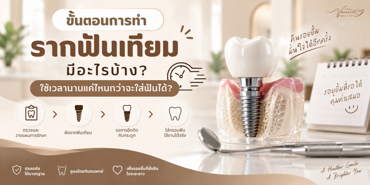 ขั้นตอนการทำรากฟันเทียม ตั้งแต่ X-ray CBCT วาง Implant จนถึงใส่ Ceramic Crown